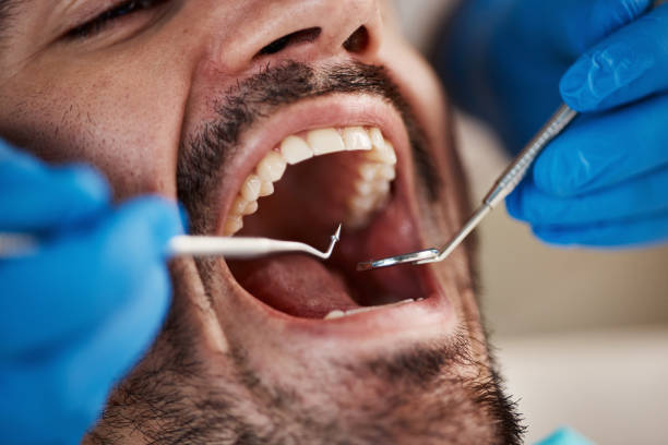 Best Urgent Care for Lost Fillings or Crowns in Murphysboro, IL